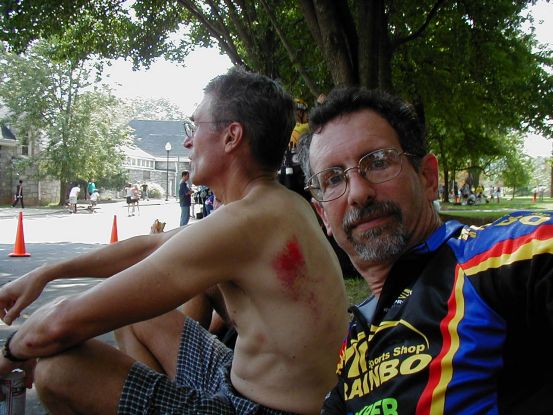As it turns out, Mike took a tumble a bit harder than those three miles.